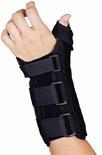 Upper extremity